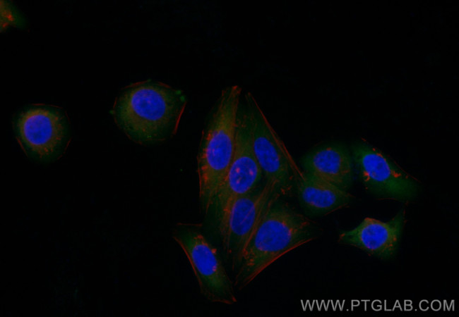 UPF1 Antibody in Immunocytochemistry (ICC/IF)