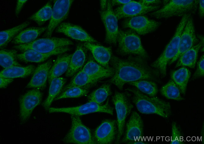 UBQLN2 Antibody in Immunocytochemistry (ICC/IF)