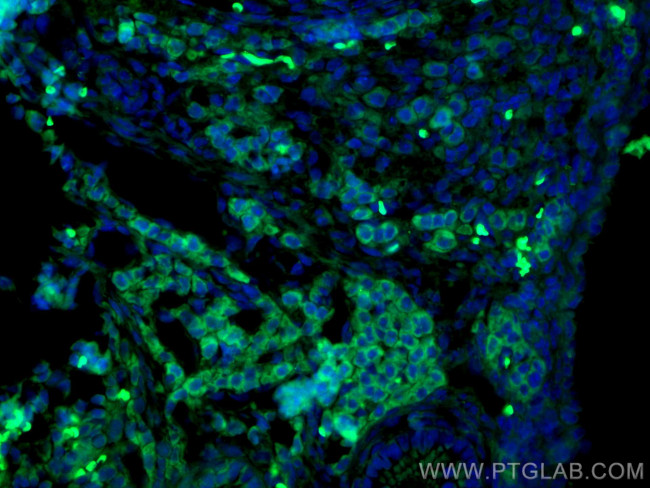 AMH Antibody in Immunohistochemistry (PFA fixed) (IHC (PFA))