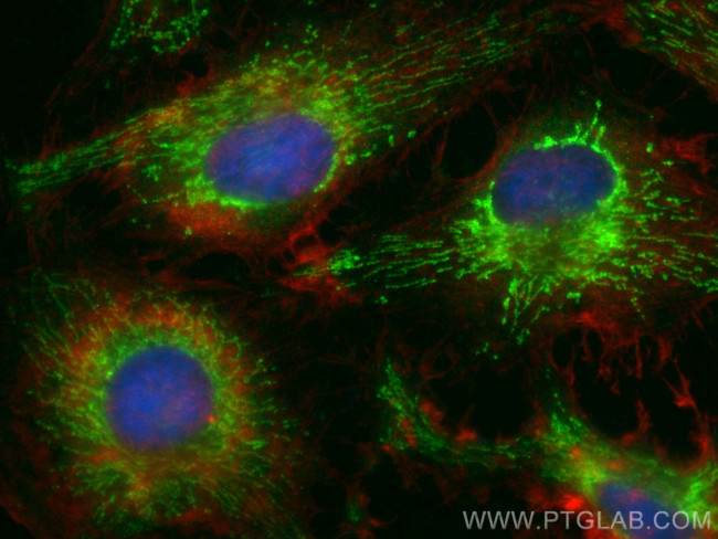 KGA/GAM/GAC Antibody in Immunocytochemistry (ICC/IF)