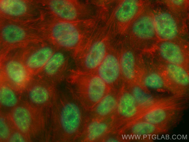 P15RS Antibody in Immunocytochemistry (ICC/IF)