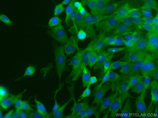 Alpha Actin Antibody in Immunocytochemistry (ICC/IF)