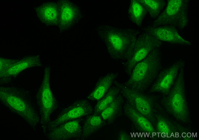 BCL3 Antibody in Immunocytochemistry (ICC/IF)