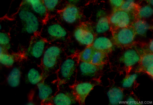 HOMEZ Antibody in Immunocytochemistry (ICC/IF)