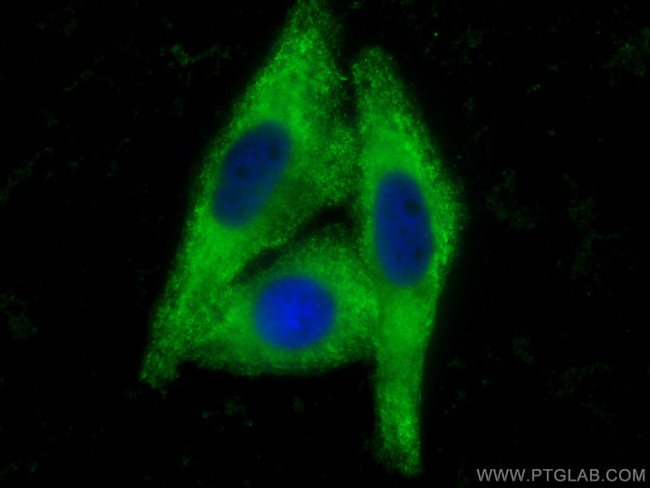 Angiotensinogen Antibody in Immunocytochemistry (ICC/IF)