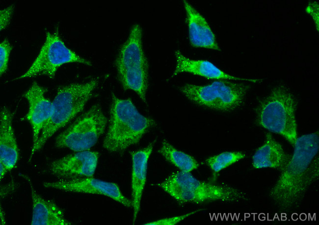 Rac1 Antibody in Immunocytochemistry (ICC/IF)