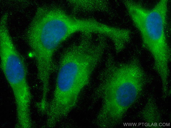 IL-28B/IFNL3 Antibody in Immunocytochemistry (ICC/IF)