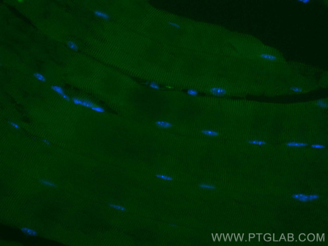 ACTN3 Antibody in Immunohistochemistry (PFA fixed) (IHC (PFA))