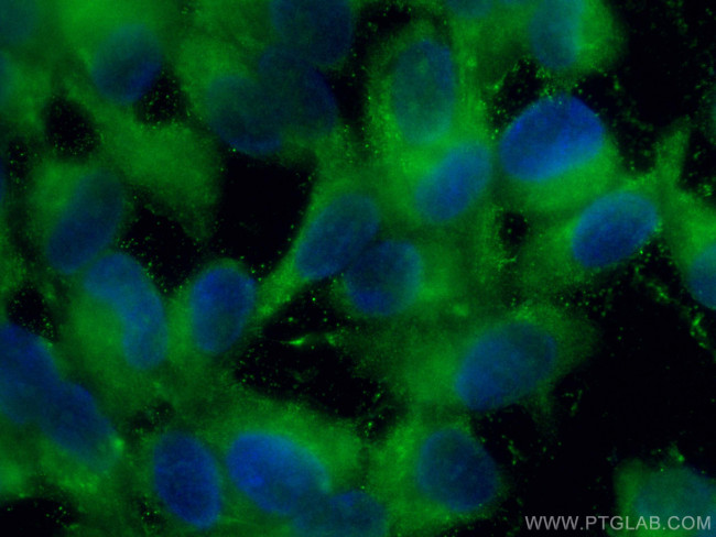 RS1 Antibody in Immunocytochemistry (ICC/IF)