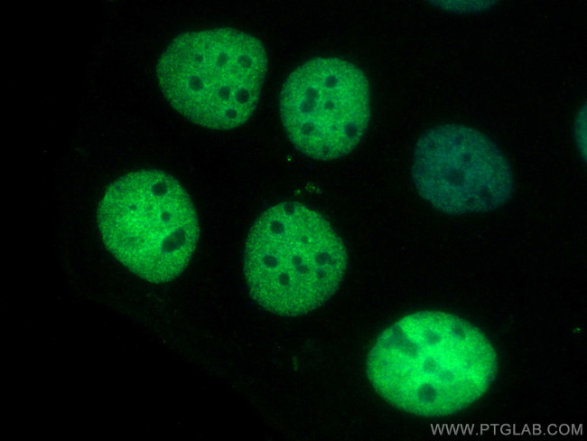 SALL4 Antibody in Immunocytochemistry (ICC/IF)