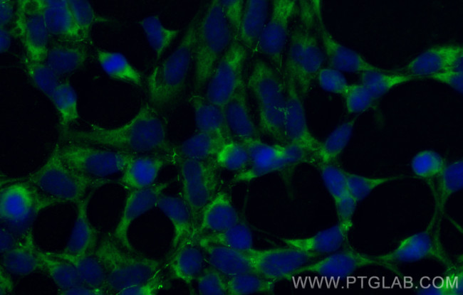 AMOT Antibody in Immunocytochemistry (ICC/IF)