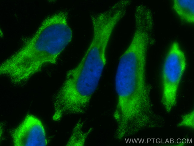 ZW10 Antibody in Immunocytochemistry (ICC/IF)