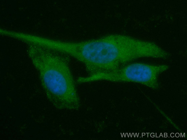 PCOTH Antibody in Immunocytochemistry (ICC/IF)