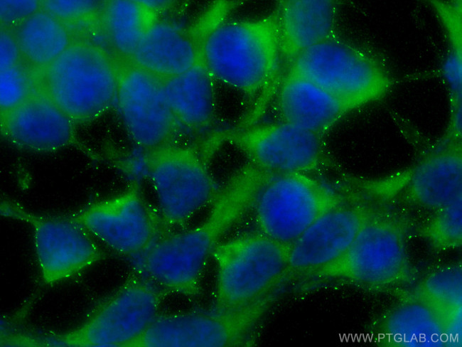 Tuberin/TSC2 Antibody in Immunocytochemistry (ICC/IF)