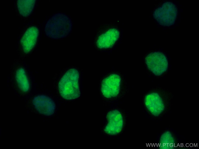 TOP2A Antibody in Immunocytochemistry (ICC/IF)