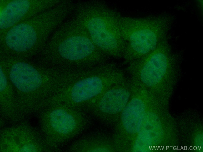 SRA1 Antibody in Immunocytochemistry (ICC/IF)