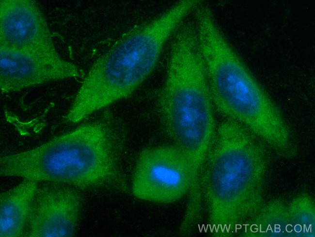 INSIG2 Antibody in Immunocytochemistry (ICC/IF)