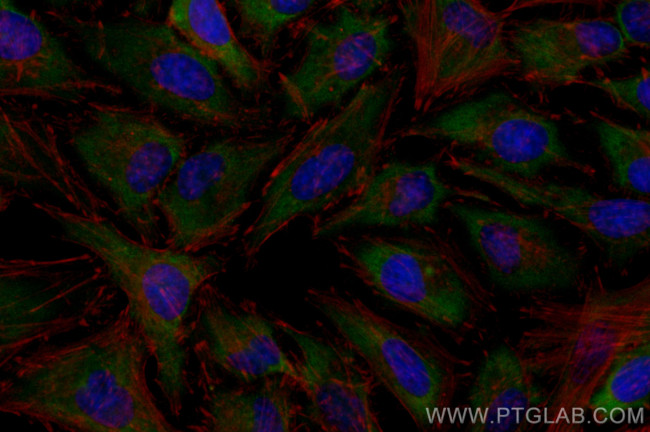 GIGYF2 Antibody in Immunocytochemistry (ICC/IF)