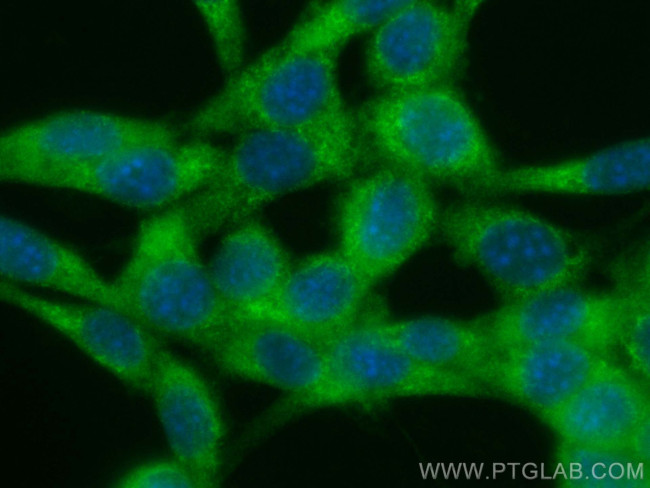 CCT2 Antibody in Immunocytochemistry (ICC/IF)