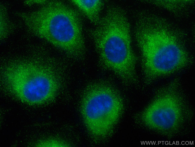 GRAMD1B Antibody in Immunocytochemistry (ICC/IF)