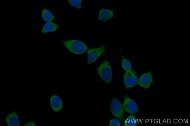 HDAC10 Antibody in Immunocytochemistry (ICC/IF)