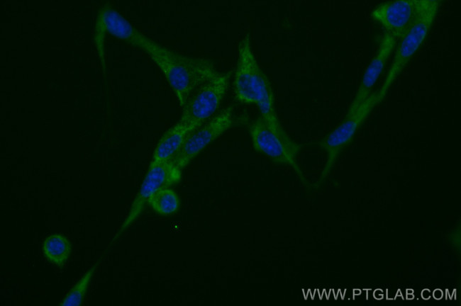 ADAMTS12 Antibody in Immunocytochemistry (ICC/IF)