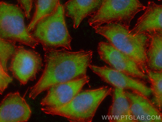C6orf15 Antibody in Immunocytochemistry (ICC/IF)