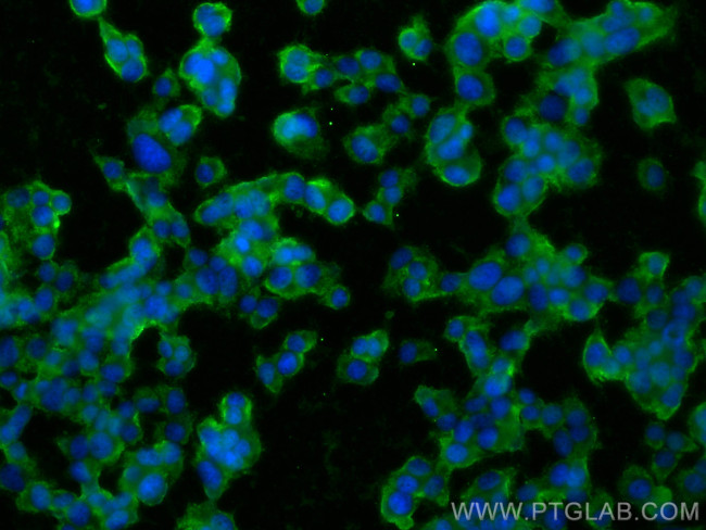 HuD Antibody in Immunocytochemistry (ICC/IF)
