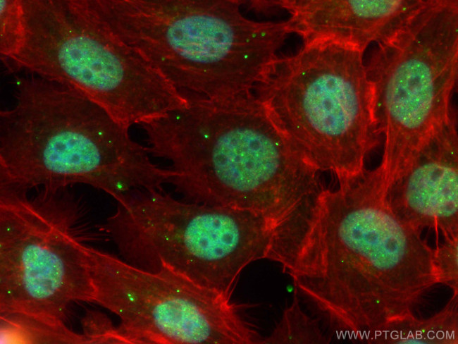 MORC3 Antibody in Immunocytochemistry (ICC/IF)