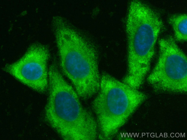 QPRT Antibody in Immunocytochemistry (ICC/IF)