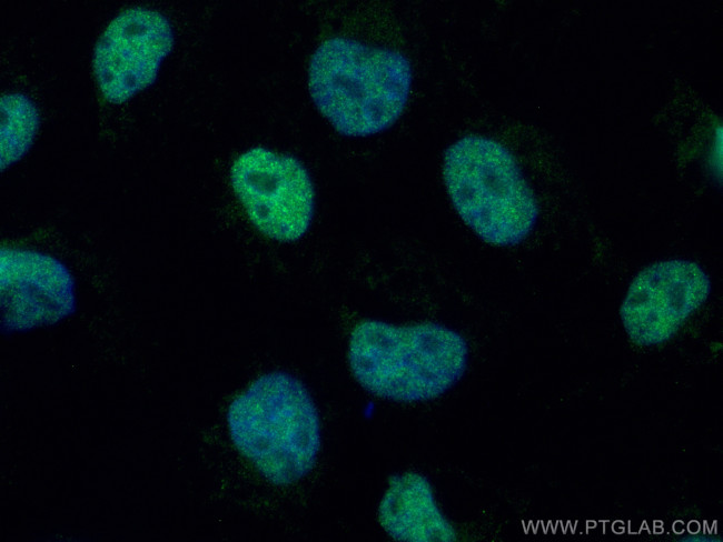 ZKSCAN1 Antibody in Immunocytochemistry (ICC/IF)