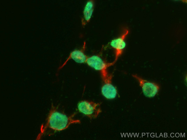 PHOX2B Antibody in Immunocytochemistry (ICC/IF)
