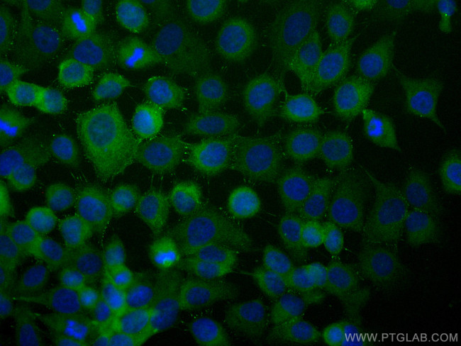 Desmoplakin Antibody in Immunocytochemistry (ICC/IF)