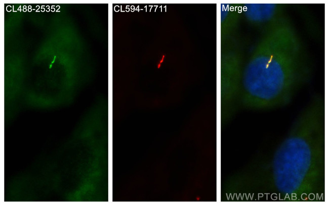 TTC30A Antibody in Immunocytochemistry (ICC/IF)