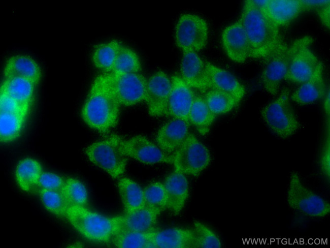 YTHDF3 Antibody in Immunocytochemistry (ICC/IF)