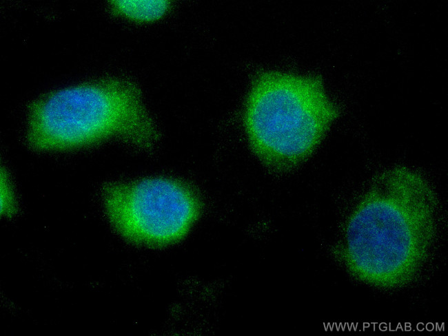 TEX264 Antibody in Immunocytochemistry (ICC/IF)