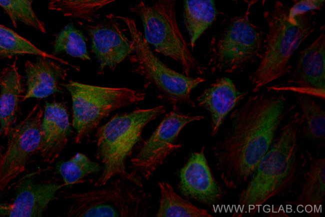 APOL2 Antibody in Immunocytochemistry (ICC/IF)