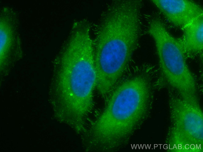 Moesin Antibody in Immunocytochemistry (ICC/IF)