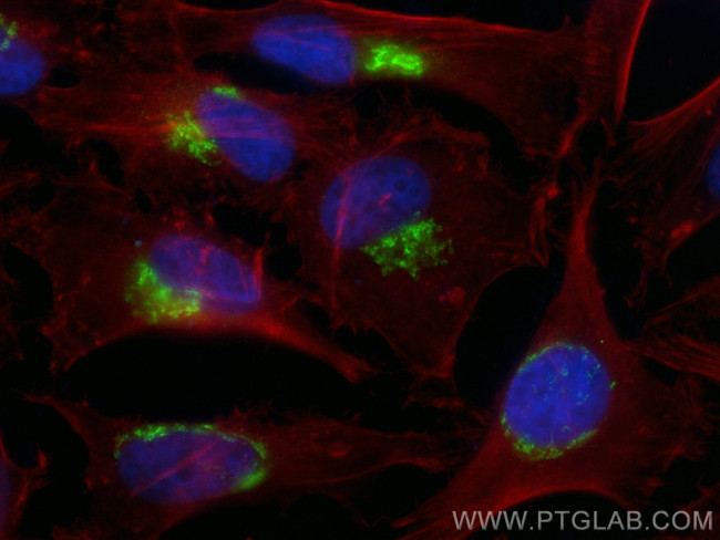 GMAP-210 Antibody in Immunocytochemistry (ICC/IF)