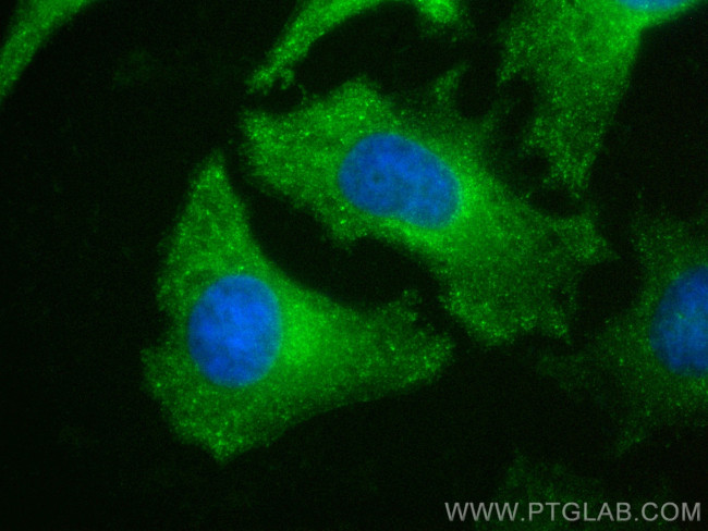 CLTC Antibody in Immunocytochemistry (ICC/IF)
