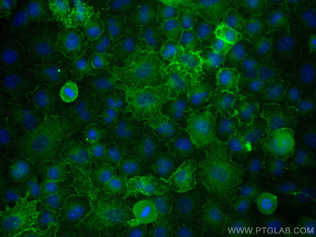 CD55 Antibody in Immunocytochemistry (ICC/IF)