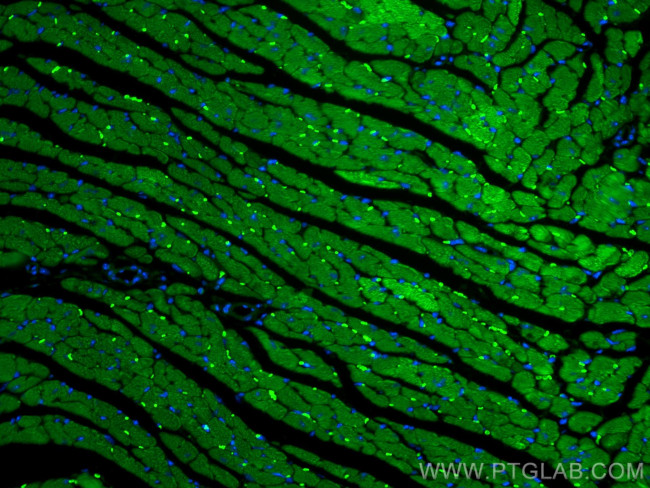 Cardiac Troponin T Antibody in Immunohistochemistry (PFA fixed) (IHC (PFA))