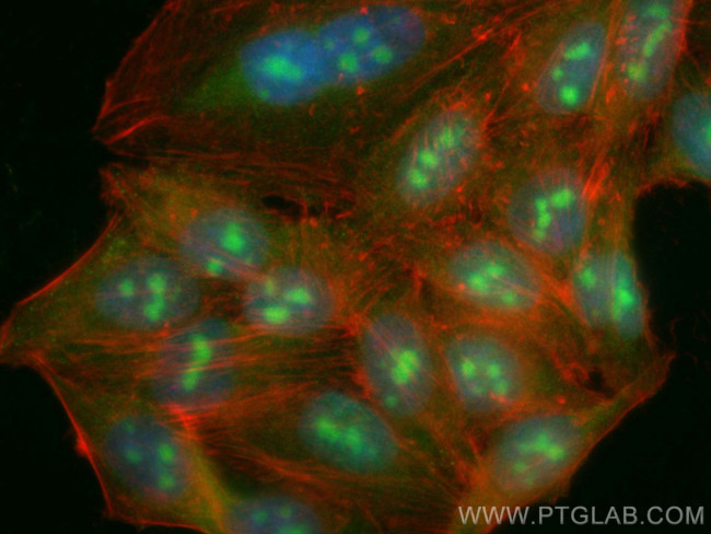 P27/KIP1 Antibody in Immunocytochemistry (ICC/IF)