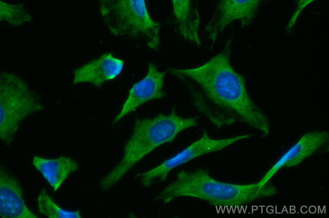 SUFU Antibody in Immunocytochemistry (ICC/IF)