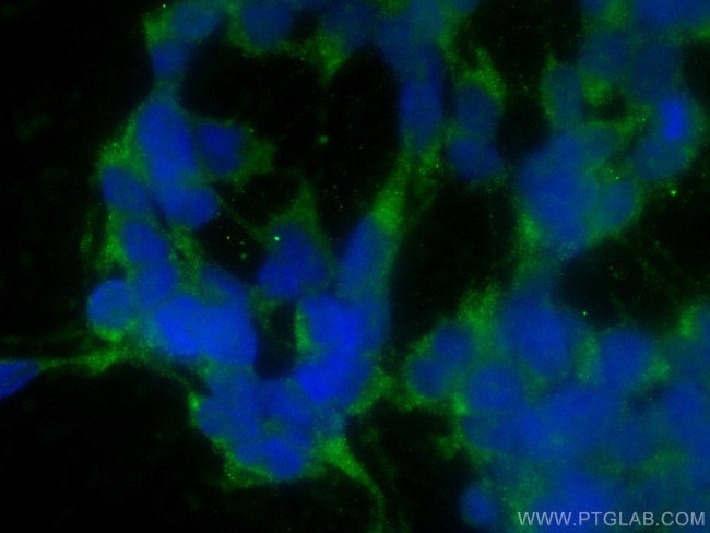 Fibrillin 1 Antibody in Immunocytochemistry (ICC/IF)