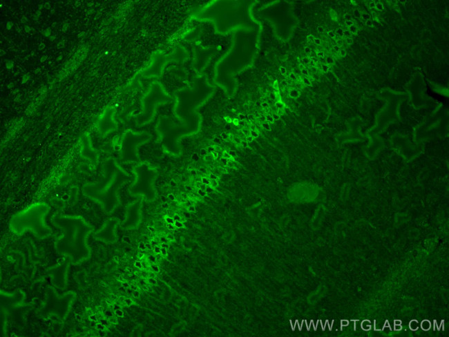 WFS1 Antibody in Immunohistochemistry (PFA fixed) (IHC (PFA))