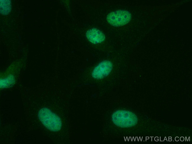 RAD21 Antibody in Immunocytochemistry (ICC/IF)