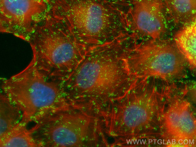 Integrin Alpha V Antibody in Immunocytochemistry (ICC/IF)