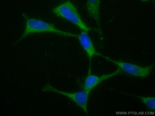 Huntingtin Antibody in Immunocytochemistry (ICC/IF)