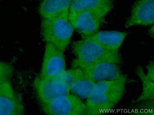 WNT2 Antibody in Immunocytochemistry (ICC/IF)